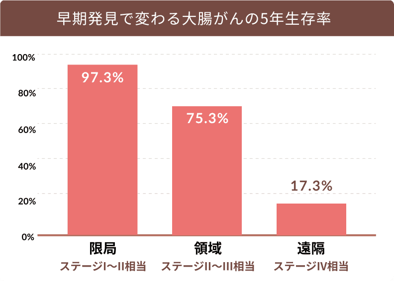 早期発見で変わる大腸がんの5年生存率。限局ステージⅠ〜Ⅱ相当97.3%、領域ステージⅡ〜Ⅲ相当75.3%、遠隔ステージⅣ相当17.3%。