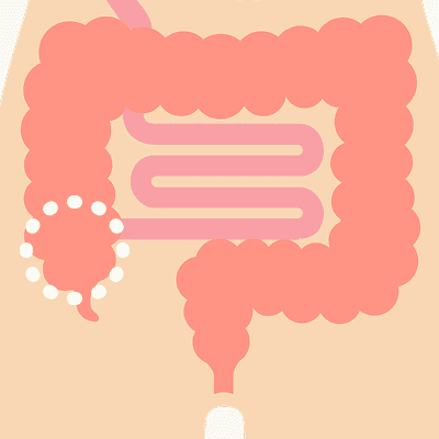 上行結腸のイラスト