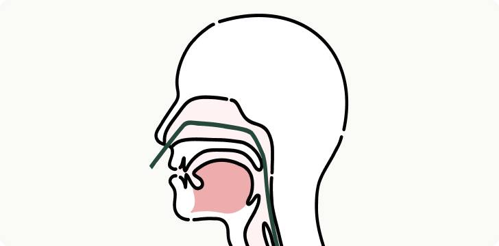鼻からの経鼻検査の図